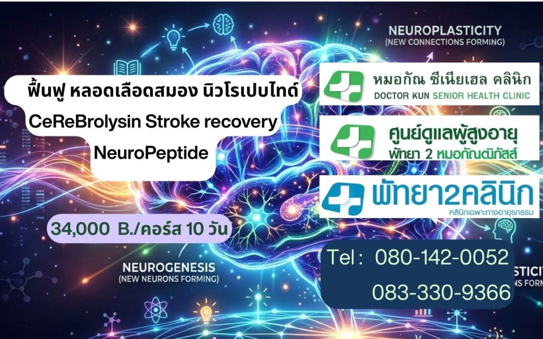 #CeReBrolysin #ฟื้นฟูหลอดเลือดสมอง 🧠 คืนชีวิตใหม่ ให้สมองและหลอดเลือด STROKE ด้วย ยาฟื้นฟูสมองโดยแพทย์เฉพาะทาง (ผู้ป่วยหลอดเลือดสมอง)